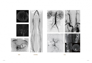 高端医疗器械国产化“逆袭”之旅，万东金刚DSA技术优势凸显