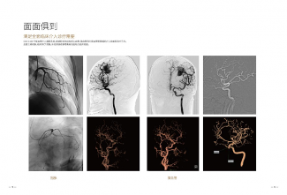 高端医疗器械国产化“逆袭”之旅，万东金刚DSA技术优势凸显