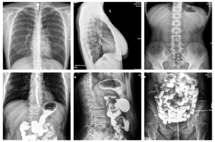 2020年动态多功能胃肠DR销量排行：安健科技腾灵稳居行业第一