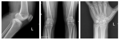 2020年动态多功能胃肠DR销量排行：安健科技腾灵稳居行业第一