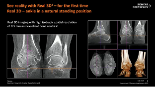 DR迎来三维化全面浪潮 安健科技与西门子已先行