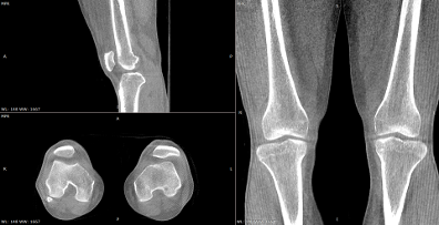 DR迎来三维化全面浪潮 安健科技与西门子已先行