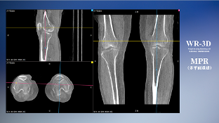 趋势已成 西门子与安健科技引领普放朝三维化发展