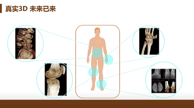 趋势已成 西门子与安健科技引领普放朝三维化发展