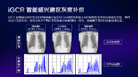 数字化X线摄影未来趋势之超低剂量化