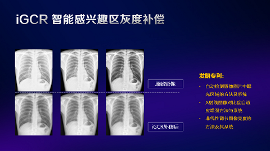 数字化X线摄影未来趋势之超低剂量化