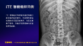数字化X线摄影未来趋势之超低剂量化
