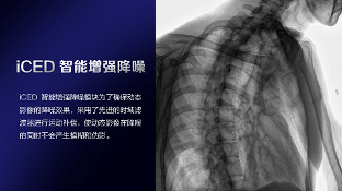 数字化X线摄影未来趋势之超低剂量化
