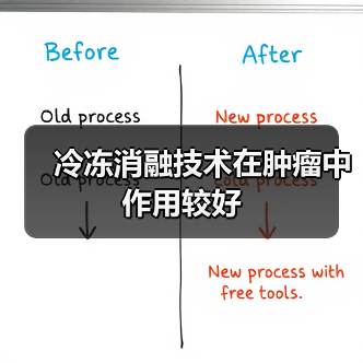 冷冻消融技术在肿瘤中作用较好(图2) 冷冻消融技术在肿瘤中作用较好(图2)