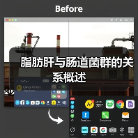 脂肪肝与肠道菌群的关系概述（图4）