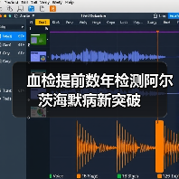 血检提前数年检测阿尔茨海默病新突破(图1) 血检提前数年检测阿尔茨海默病新突破(图1)